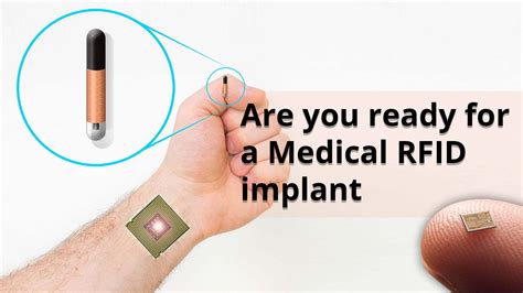 rfid chip insertable|microchip vs rfid.